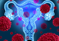 Хориокарцинома матки: причины, симптомы, лечение