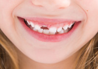 В каком порядке меняются зубы у детей