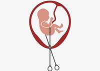 Последствия аборта: можно ли считать его безопасной процедурой