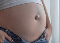 Пупочная грыжа при беременности