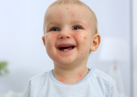 Сыпь у ребенка: разновидности, причины, действия