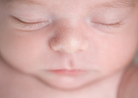 Жировики на лице у новорожденного: причины и лечение