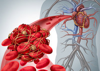 Тромбоцитоз: почему повышены тромбоциты в крови