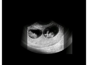 Screenshot_20210219_201739_com.hp.pregnancy.lite_1613907465961