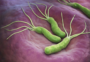Какие продукты убивают бактерию Хеликобактер Пилори