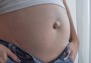 Пупочная грыжа при беременности