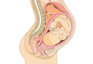 Короткая шейка матки при беременности