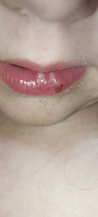 Дочь позавчера ударилась губой.