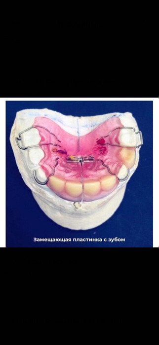 Раннее удаление зубов, кто