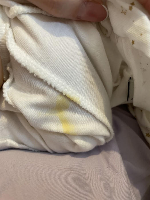 Новорожденный срыгнул желтым