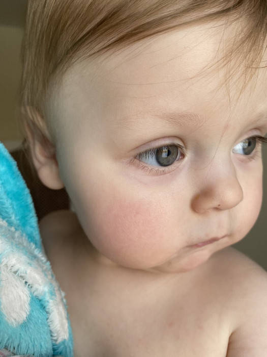 Увлажняющий детский крем и может быть это аллергия?
