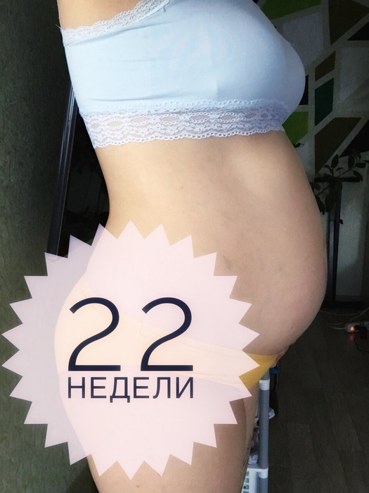 22 недели беременности.