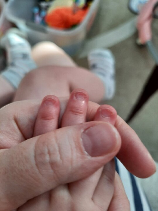 Ногти у дочи странной формы