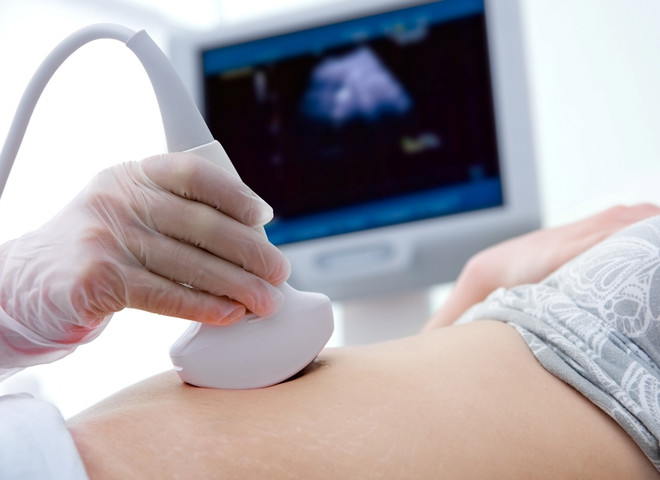 ретрохориальная гематома при беременности