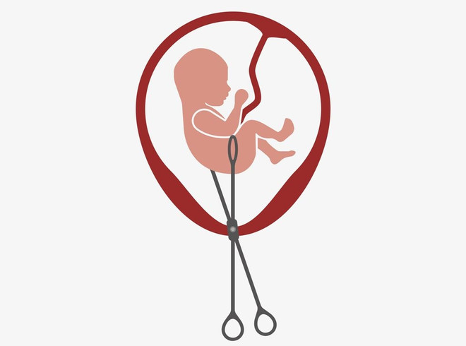 Какие есть виды медицинского аборта