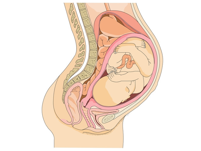 Короткая шейка матки при беременности