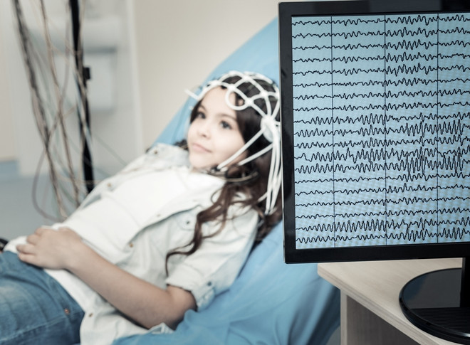 Что такое эпилепсия и как возникают приступы