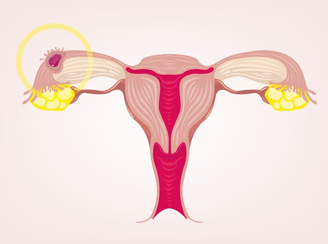 Как происходит процесс имплантации эмбриона