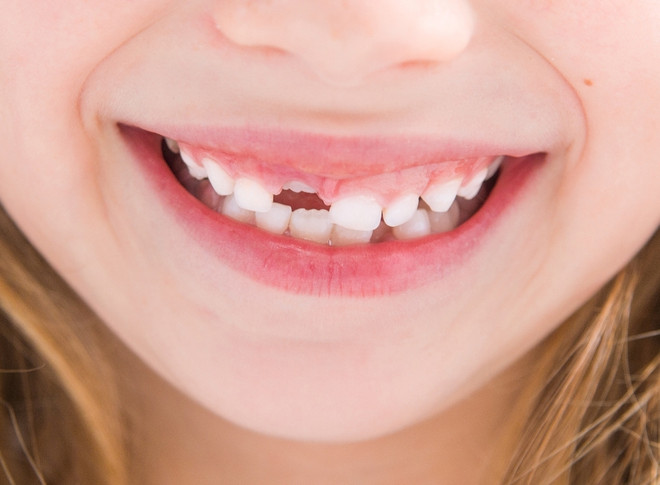 в каком порядке меняются зубы у детей