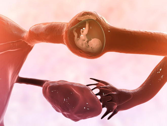 хгч показывает внематочную беременность