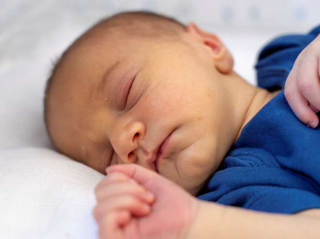 Желтизна кожи при повышенном билирубине у новорожденного