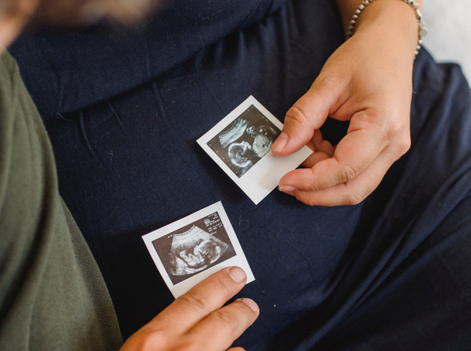 редукция эмбриона при многоплодной беременности