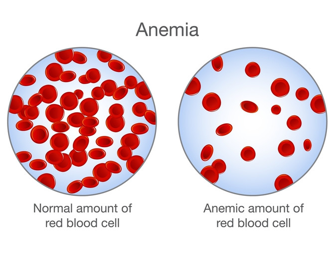 гемоглобин при беременности анемия