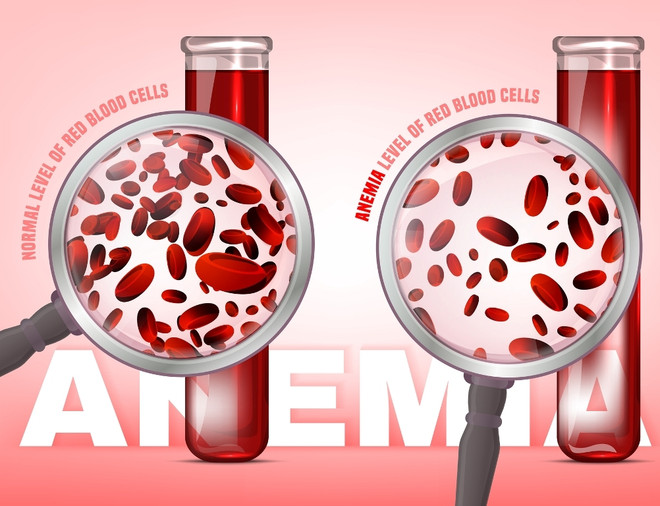 норма гемоглобина в крови у детей анемия
