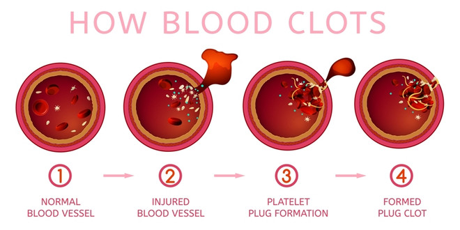 свертываемость крови у женщины