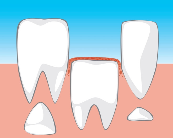 смена зубов у детей порядок выпадения
