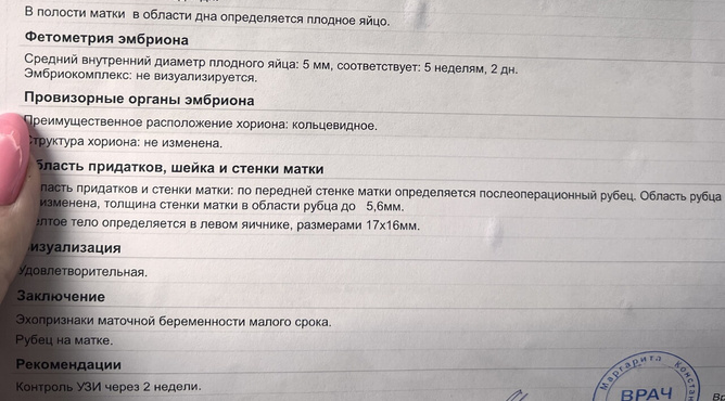 Поздняя овуляция ?