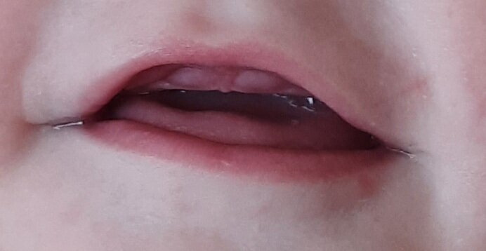 Зубы