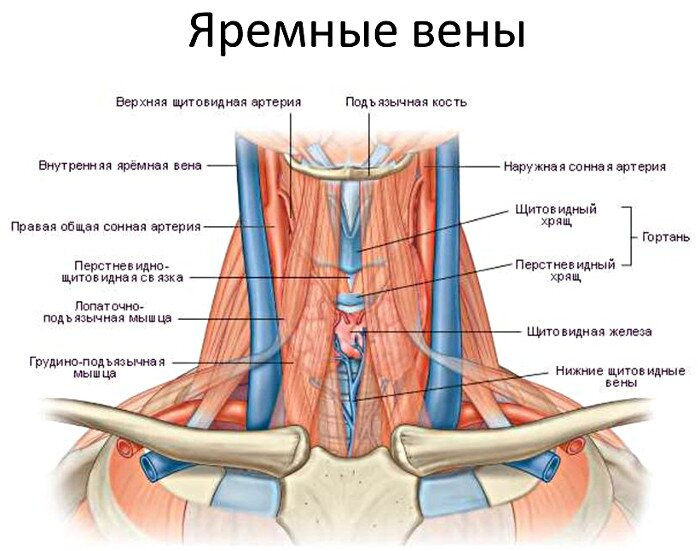 Эктазия внутренних яремных вен с двух сторон.