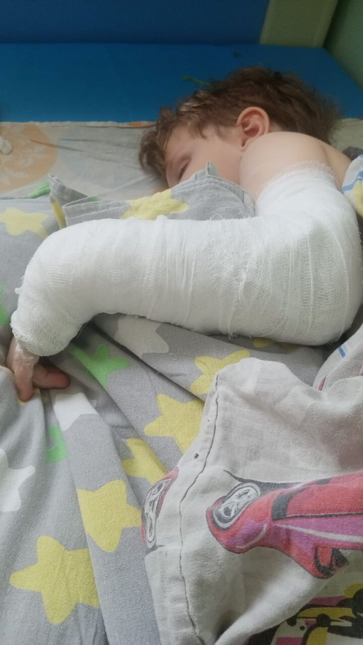 Гипс