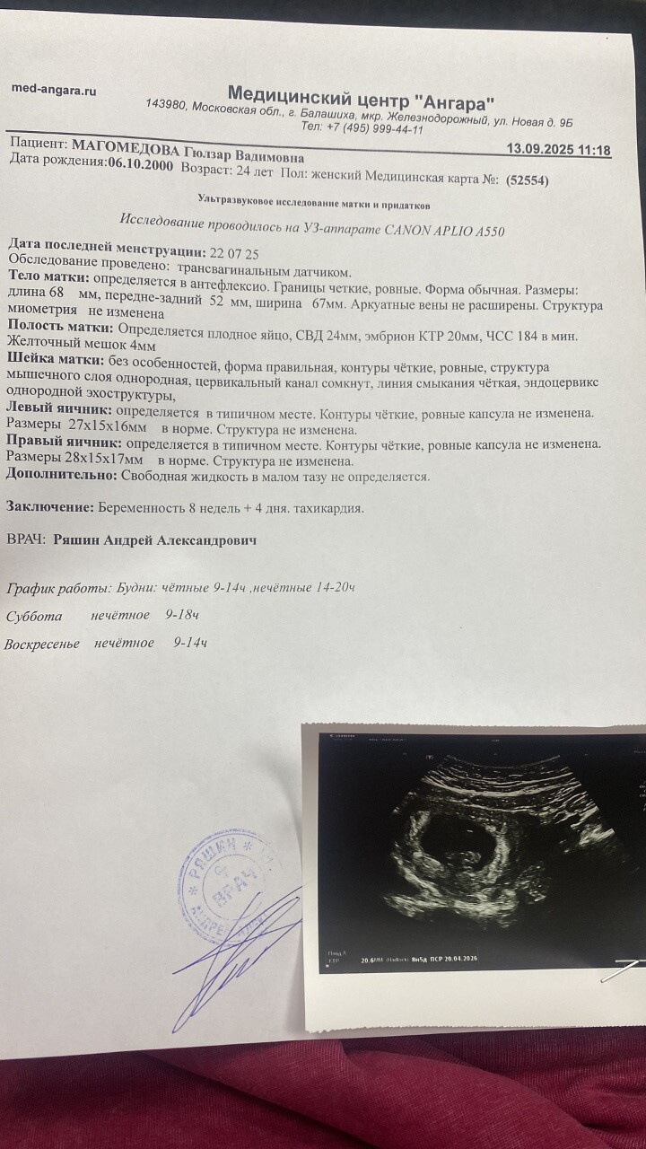 8 недель 4-5 дней . Тахикардия плода