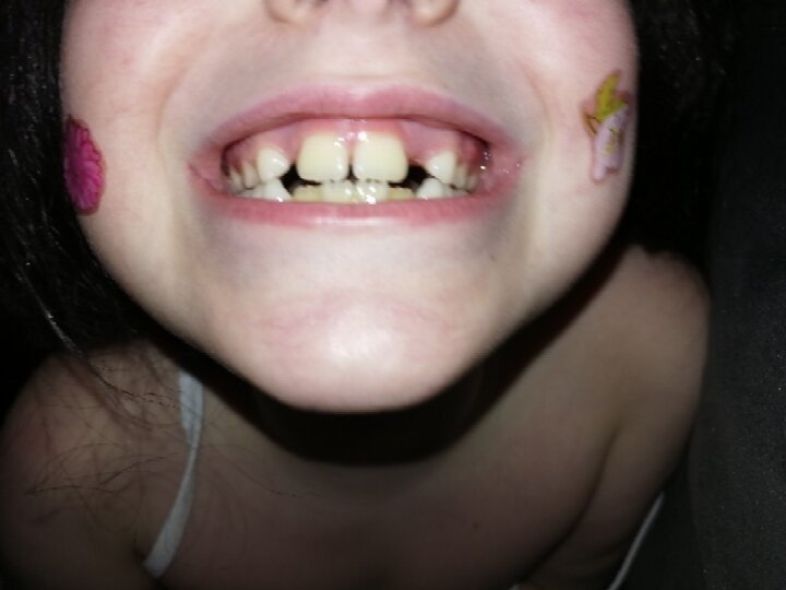Коренные зубы и их