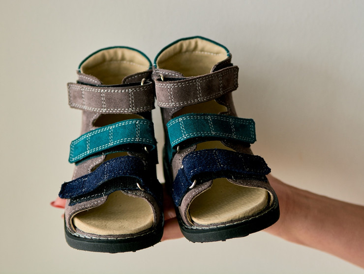 Ортопедическая обувь для детей: виды и назначение