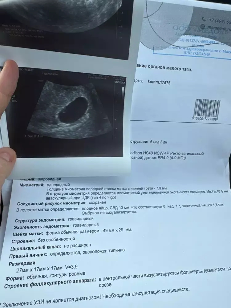 Анэмбриония? Конец? 😭