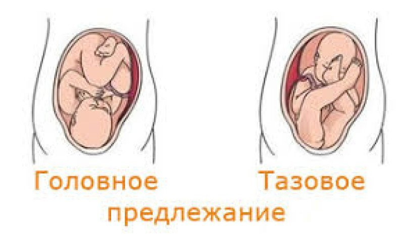 Маленьктй секрет для беременных