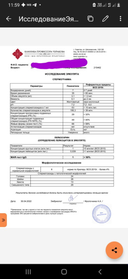 Спермография.