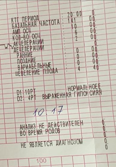 Ктг Сегодня сделала.