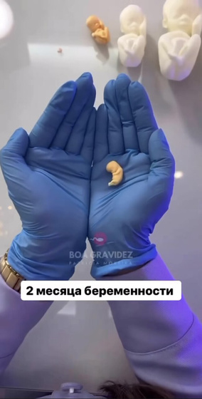 Кроха 2 мес