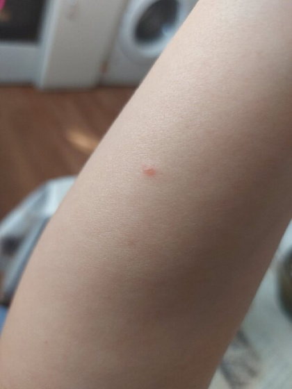 На что похожи высыпание,