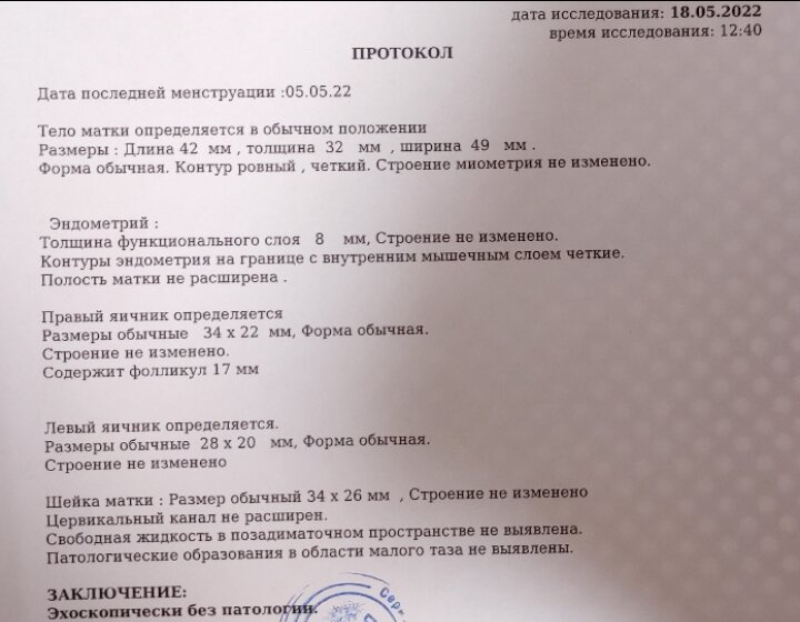 Вроде овуляция есть.