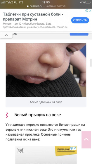 Маленькие прыщики у новорожденных