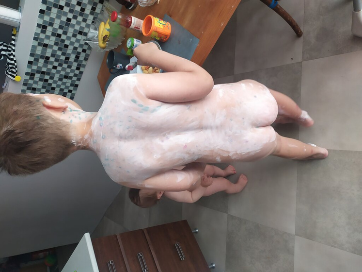 Ох уж эта ветрянка 😭😭😭