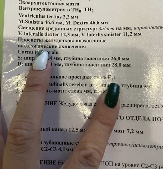 Нейросонография