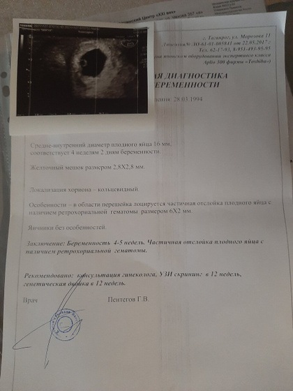 К мажущим выделениям вчера