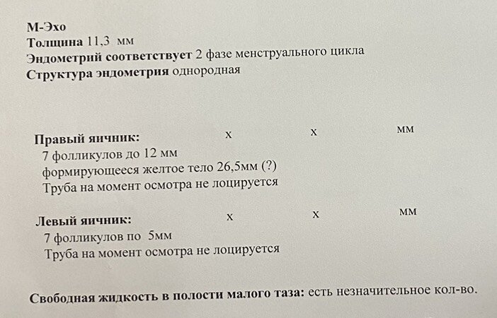 1 ДПО , а может и сам день О 😅