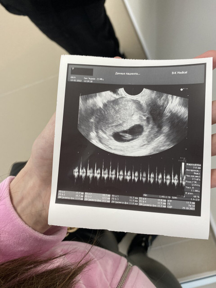 Сегодня уже слышно сердечко 😍🥰